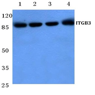 Integrin (beta)3 (T767) pAb