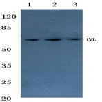 Involucrin (P568) pAb