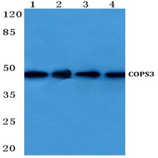 COPS3 (M408) pAb