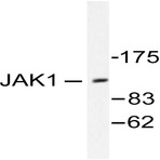 JAK1 (I1016) pAb