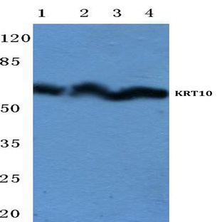 Cytokeratin 10 (Y160) pAb