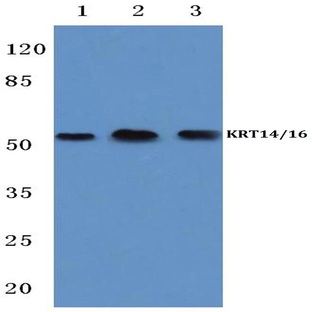 Cytokeratin 14/16 (S5) pAb