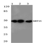 Cytokeratin 15 (T12) pAb