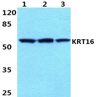 Cytokeratin 16 (S451) pAb