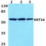 Cytokeratin 16 (S451) pAb