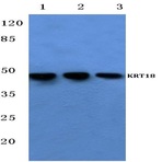 Cytokeratin 18 (T410) pAb