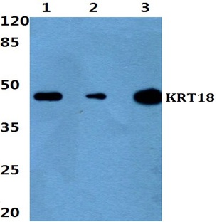 Cytokeratin 18 (P27) pAb