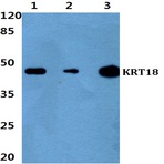 Cytokeratin 18 (P27) pAb