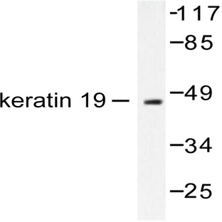 Cytokeratin 19 (M259) pAb