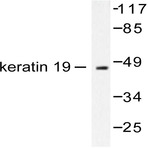 Cytokeratin 19 (M259) pAb