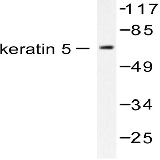 Cytokeratin 5 (S573) pAb