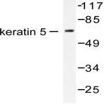 Cytokeratin 5 (S573) pAb