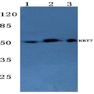 Cytokeratin 7 (L451) pAb