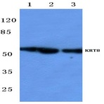 Cytokeratin 8 (V463) pAb