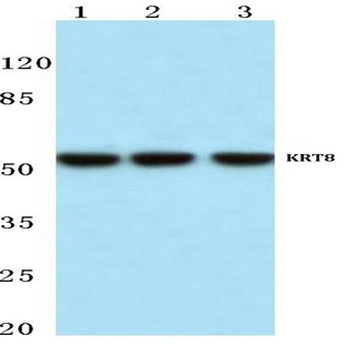 Cytokeratin 8 (V67) pAb