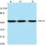 Cytokeratin 8 (V67) pAb