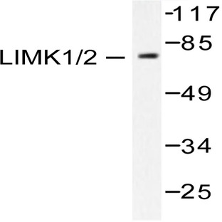 LIMK1/2 (D402) pAb