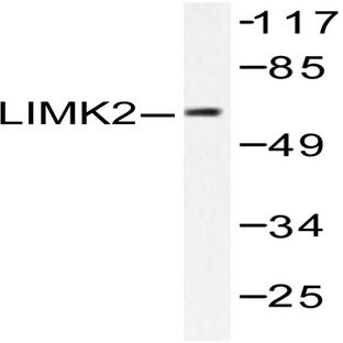 LIMK2 (D499) pAb