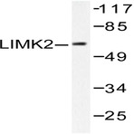 LIMK2 (D499) pAb