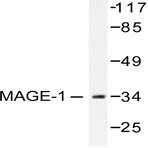 MAGE-1 (F293) pAb