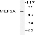 MEF-2 (A306) pAb