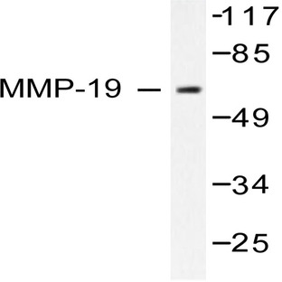 MMP-19 (G44) pAb