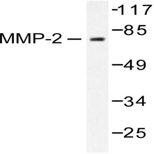 MMP-2 (L638) pAb