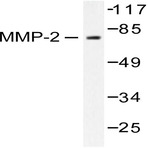 MMP-2 (L638) pAb