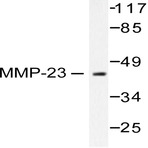 MMP-23 (V371) pAb