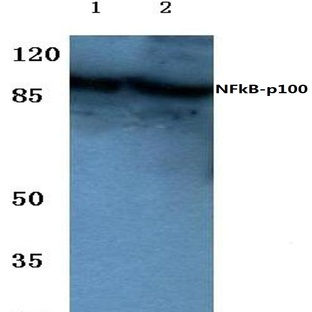 NFkB-p100 (S865) pAb