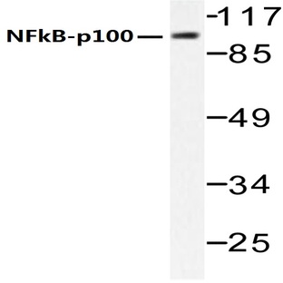 NFkB-p100 (S869) pAb