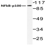 NFkB-p100 (S869) pAb