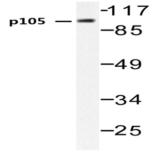 NFkB-p105 (V887) pAb