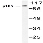 NFkB-p105 (V887) pAb