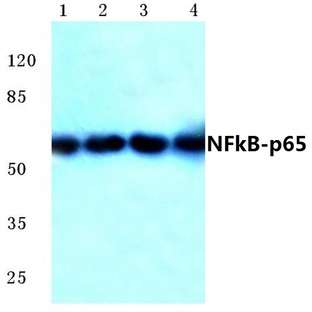 NFkB-p65 (M270) pAb