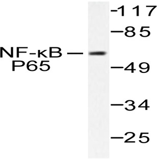 NFkB-p65 (T429) pAb