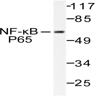 NFkB-p65 (V462) pAb