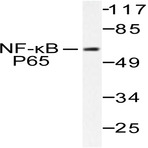 NFkB-p65 (V462) pAb