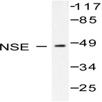 NSE/Enolase (R400) pAb