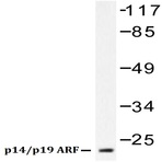 p14 ARF/p19 ARF (Q99) pAb