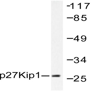 p27 Kip1 (V4) pAb