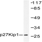 p27 Kip1 (V4) pAb