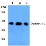 Dynactin 2 (L371) pAb