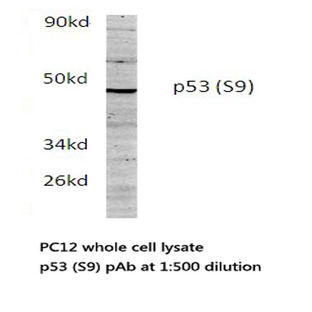 p53 (S9) pAb