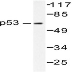 p53 (P309) pAb