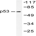 p53 (M1) pAb