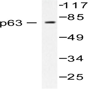 p63 (N662) pAb