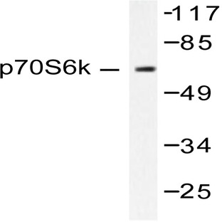 p70 S6K (F415) pAb