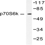 p70 S6K (F415) pAb