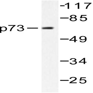 p73 (V93) pAb